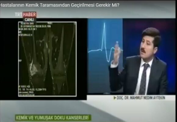 Diğer Kanser Hastalarının Kemik Taramasından Geçirilmesi Gerekir Mi?