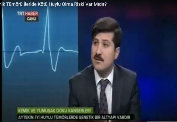 İyi Huylu Kemik Tümörü İleride Kötü Huylu Olma Riski Var Mıdır?