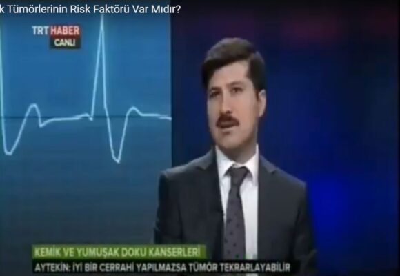 İyi Huylu Kemik Tümörlerinin Risk Faktörü Var Mıdır?