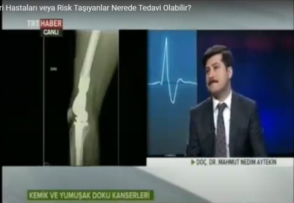Kemik Kanseri Hastaları veya Risk Taşıyanlar Nerede Tedavi Olabilir?