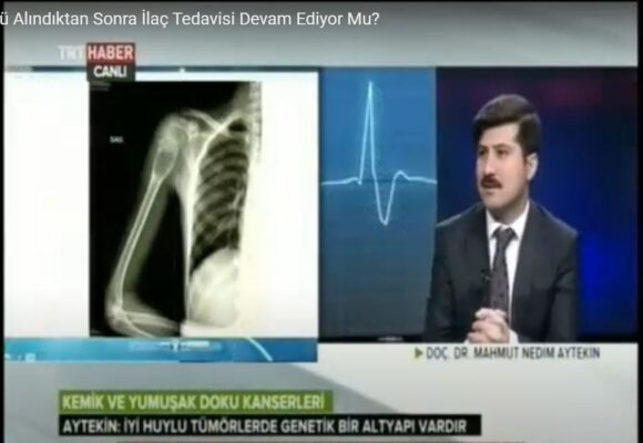 Kemik Tümörü Alındıktan Sonra İlaç Tedavisi Devam Ediyor Mu?