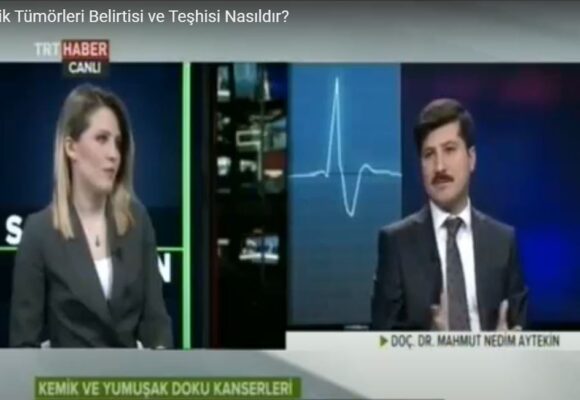 Kemik Tümörüne – Genetik Risk Faktörü Nasıldır?