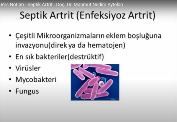 Tıp Fakültesi Ders Notları – Septik Artrit